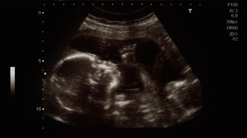 Ми знаємо, що вони вбивають дітей – усі ми це знаємо!